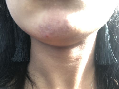 Customer photo review of Fair and White Original Whitening Gel Cream 30 gm / 1 fl oz