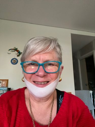 Customer photo review of Anti-Wrinkle Patches (All-in-one)