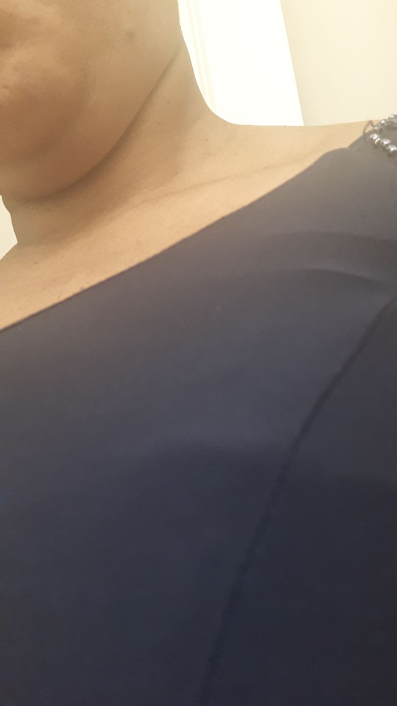 Customer photo review of Fair and White So White Skin Perfector Purifying Cream 250ml / 8.4 fl oz
