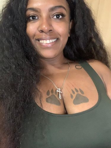 Customer photo review of BERRI-CLEAR+™ SUPERFRUIT 5 BERRY SERUM