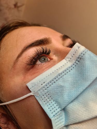 Customer photo review of Super Powers 1 second glue