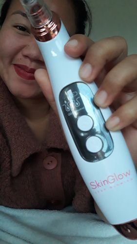 Customer photo review of SkinGlow Digital Electric Cleanser Pro - Limited Edition