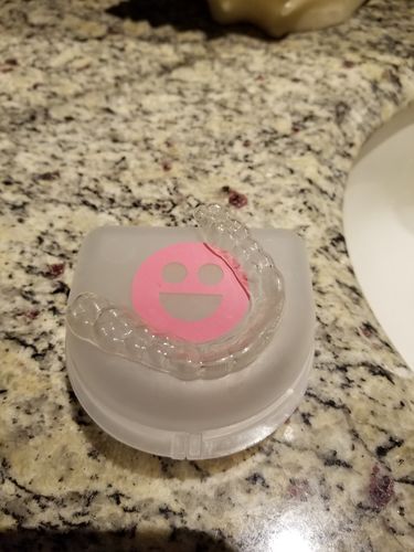 Customer photo review of Night Guard