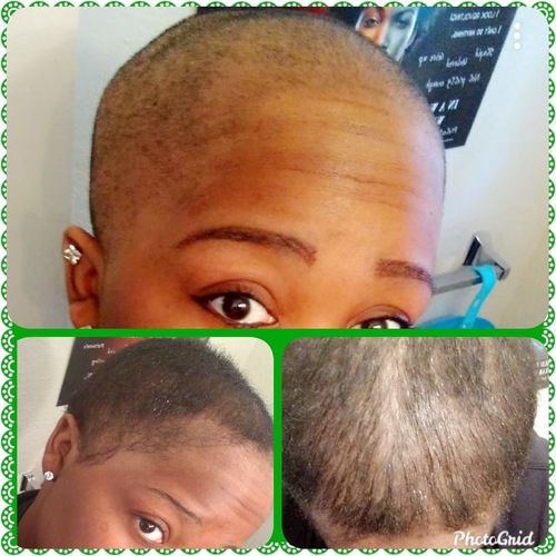 Customer photo review of PureFix Hair Elixir