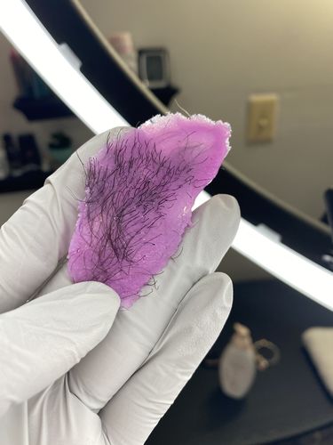 Customer photo review of Signature Series Hair Removal Wax