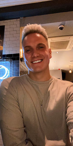 Customer photo review of Teeth Whitening Kit