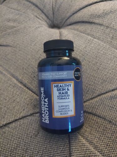 Customer photo review of HANDSOME BROTHA-Healthy Skin & Hair Advanced Formula (45 Day Supply/ .64 Cent A Day) CLICK HERE