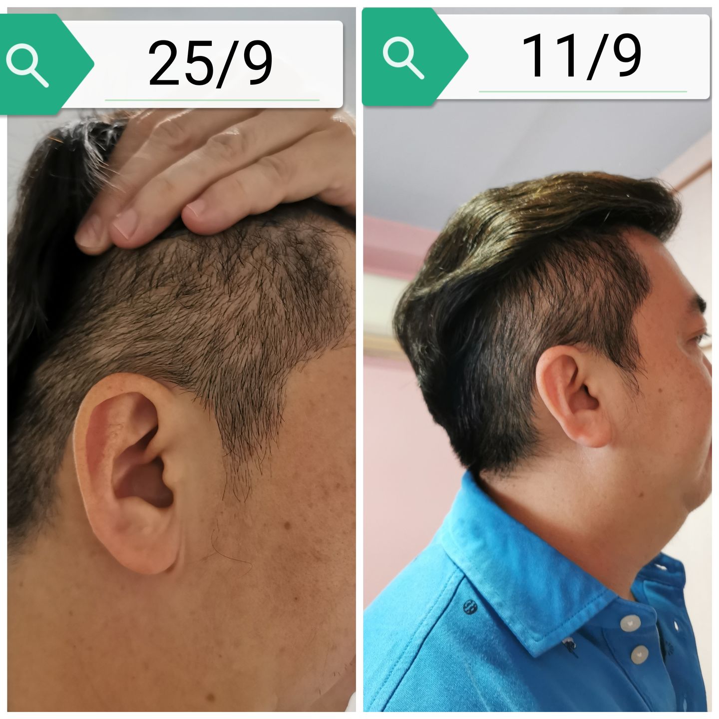 Customer photo review of [ SMIB ] - Premium Starter Kits 500ml Set