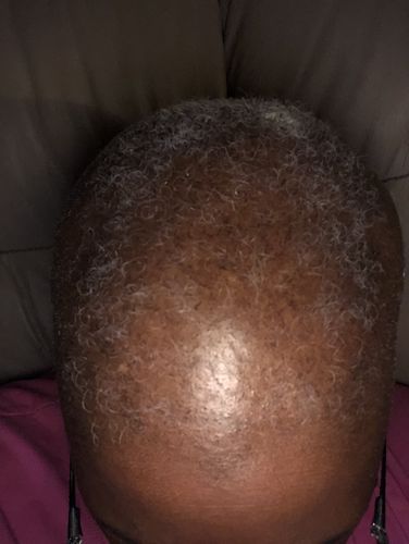 Customer photo review of PureFix Hair Elixir