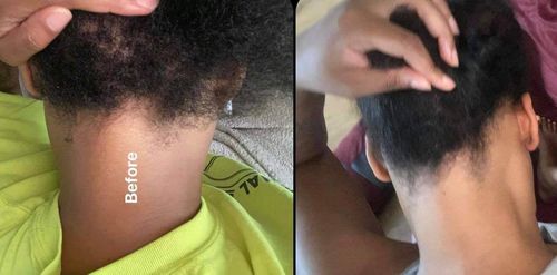 Customer photo review of TWO India’s Secret Herbal Growth Stimulators