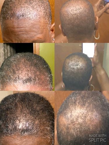 Customer photo review of PureFix Hair Elixir