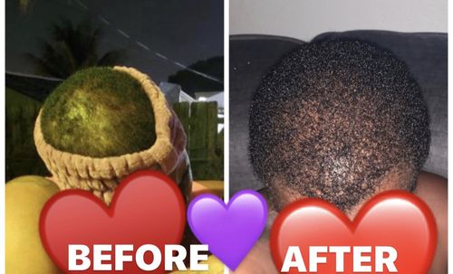 Customer photo review of PureFix Hair Elixir