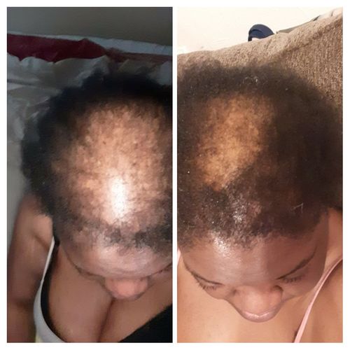 Customer photo review of PureFix Hair Elixir