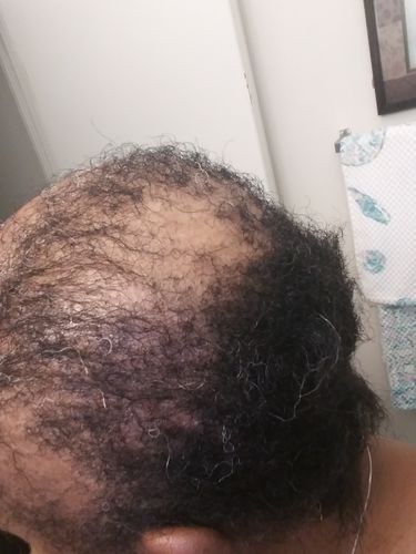 Customer photo review of PureFix Hair Elixir