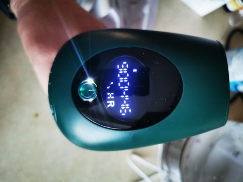 Customer photo review of Upgraded IPL Laser Hair Removal Handset - Painless Electric Epilator
