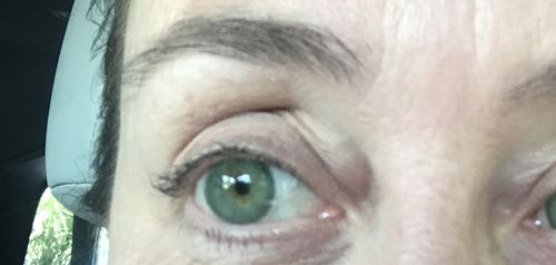 Customer photo review of Icoloured® Bee Green Toric Colored Contact Lenses
