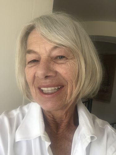 Customer photo review of APEX™ Lite (Clear)