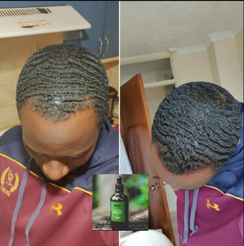 Customer photo review of Inches - Ayurvedic Hair & Beard Growth Oil