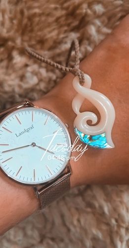 Customer photo review of World Edition Rosé Gold White