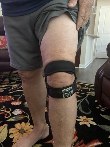 Customer photo review of PositVibe Patella Stabilizer