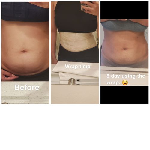 Customer photo review of 45 Uses Herbal Magnesium Therapy Wrap: Legs/Core