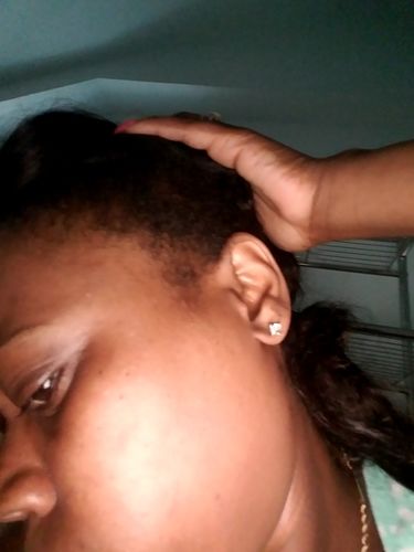 Customer photo review of Hair ReGrowth Serum