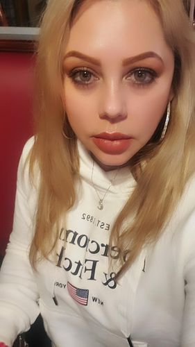 Customer photo review of SL70 Gray Contact Lenses(12 months wear)