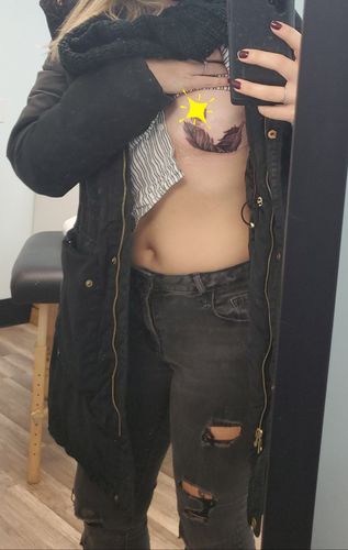 Customer photo review of Signature Numbing Cream