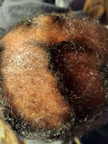 Customer photo review of PureFix Hair Elixir