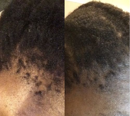 Customer photo review of Inches - Hair & Beard Growth Oil