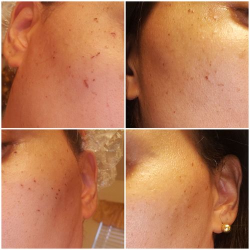 Dermavel Reviews 62 Reviews