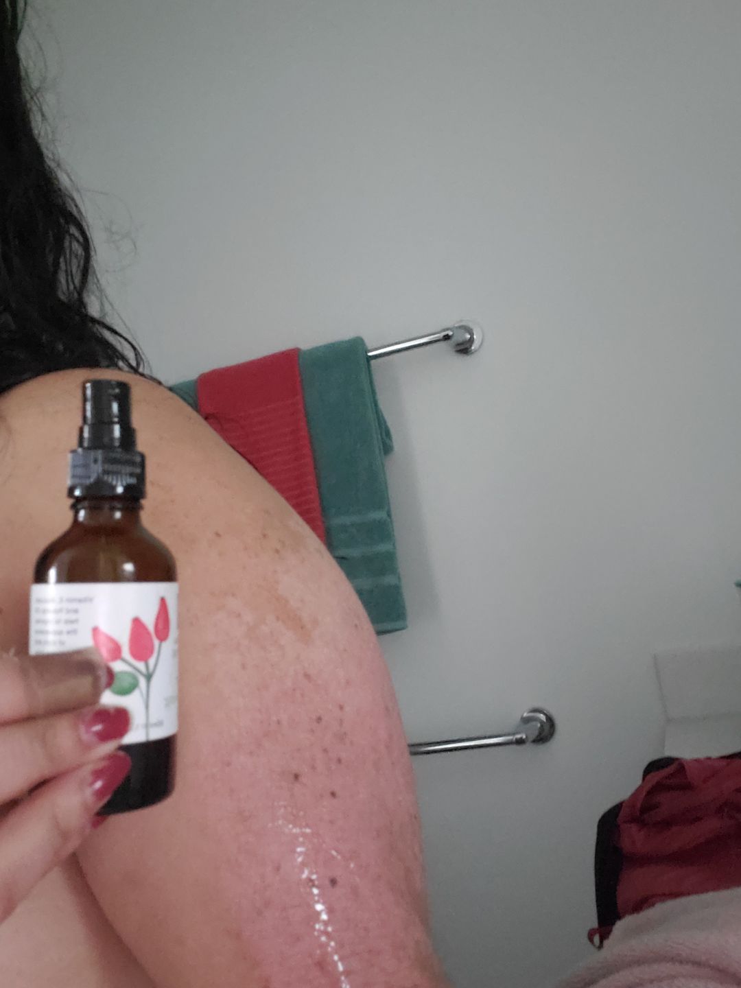 Customer photo review of Scar Minimising Oil