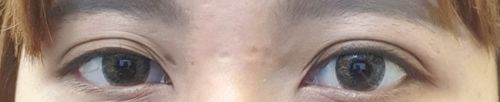 Customer photo review of Twenty My Gray (20pcs) (Silicone Hydrogel) 1Day G.DIA 13.2mm