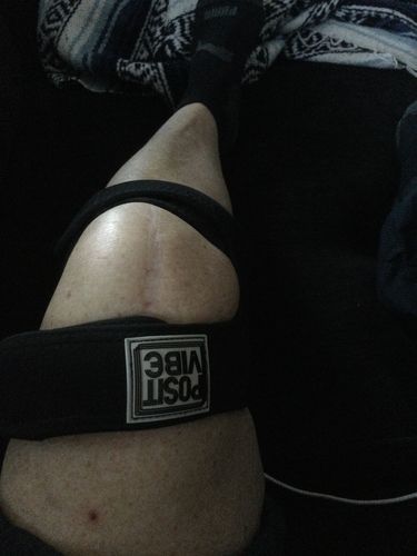 Customer photo review of PositVibe Patella Stabilizer