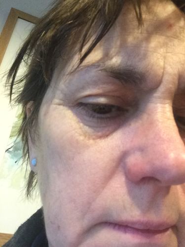 Customer photo review of Repair and Renew Cream