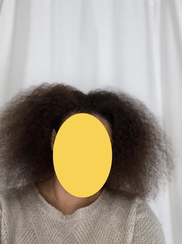 Customer photo review of In Haircare - Cure pousse de cheveux 3 mois + 1 Bonnet en Satin offert