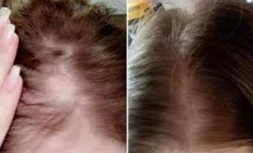 Customer photo review of Make your Hair Grow Faster Shampoo Bundle