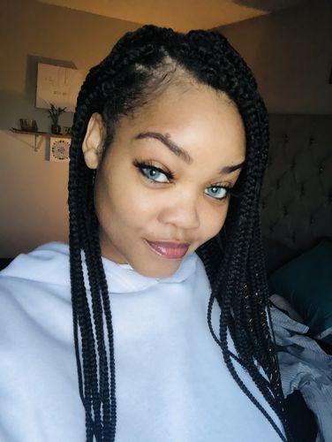 Customer photo review of Cherry Ocean Prescription Contact Lenses