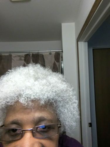 Customer photo review of Hair ReGrowth Serum (Large Bottle)