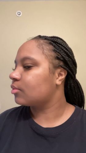 Customer photo review of 3 Pack Turmeric Soap