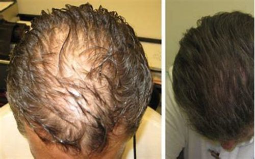 Customer photo review of Hair Growth With Argan Oil Professional Haircare Package (Shampoo + Conditioner)