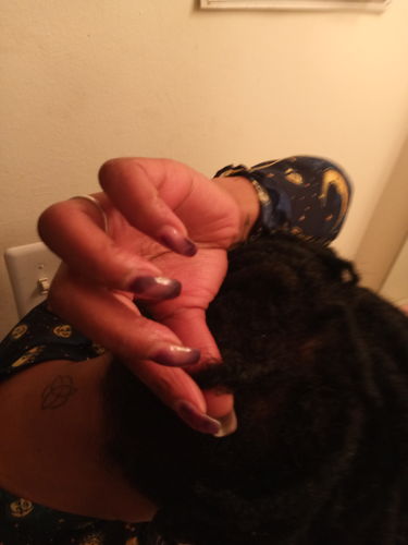 Customer photo review of Hair Growth Serum