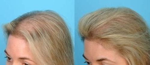 Customer photo review of Hair Growth with Argan Oil Professional Shampoo - 500ml