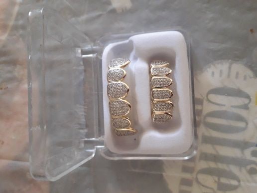Customer photo review of Two-Tone Iced Grillz