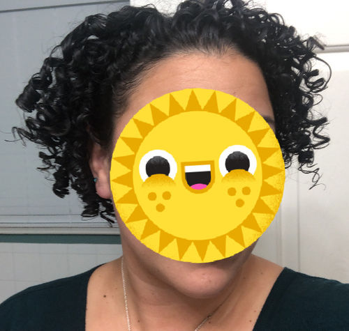 Customer photo review of LIMITED TIME - Pineapple Potion Flake LESS Defining Kit (3 Items)