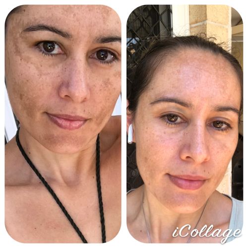 Customer photo review of Vitamin A Corrector