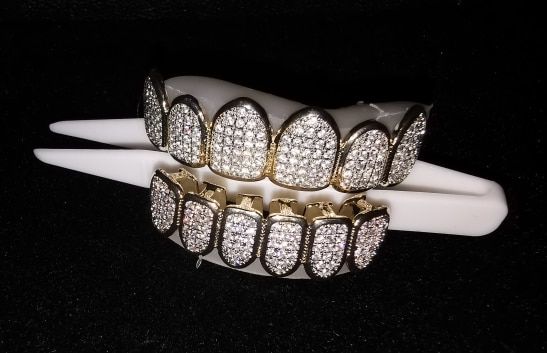 Customer photo review of Two-Tone Iced Grillz
