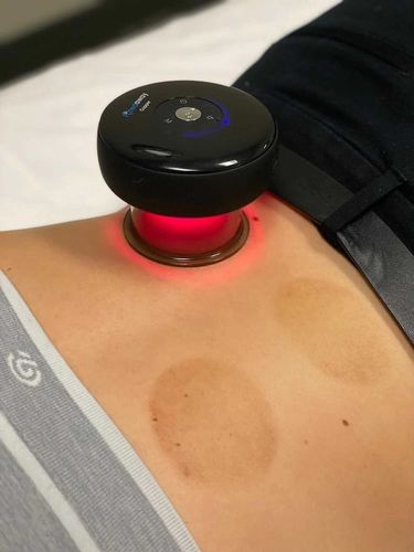 Customer photo review of Achedaway Cupper - The Smart Cupping Therapy Massager