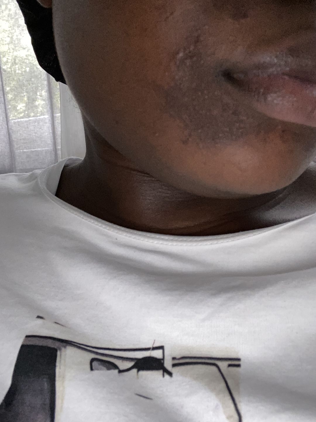 Customer photo review of SHEA SOAP