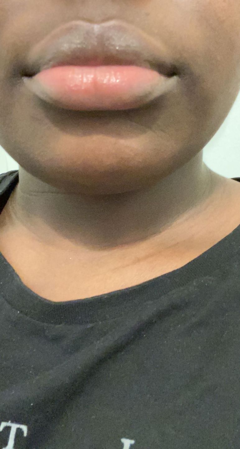Customer photo review of SHEA SOAP